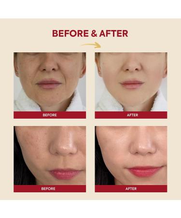 K-SECRET Snail Mucin Essence Serum - 97% Snail Secretion & Rice Extract for Hydration | SEOUL 1988 Korean Skincare 100mL - Buy Online on GoSupps.com