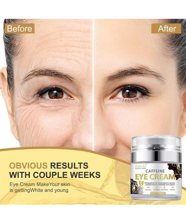 Caffeine Eye Cream for Dark Circles & Puffiness | Anti-Aging & Wrinkle Reduction with Retinol, Hyaluronic Acid, Vitamin E & Aloe Vera | Day & Night Under Eye Treatment - Buy Online on GoSupps.com