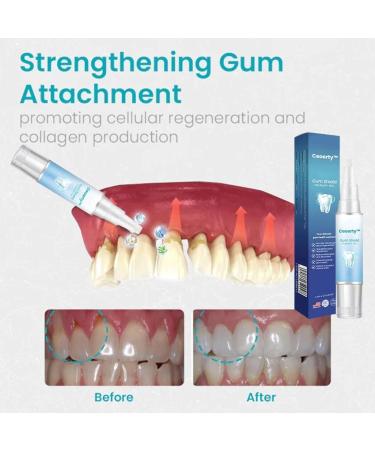 Buy Ceoerty & Dentizen Gum Shield Therapy Gel + Teeth Whitening Pen (2pcs) | Best Oral Care for Healthy Gums & Bright Smile - International Shipping Available - Buy Online on GoSupps.com
