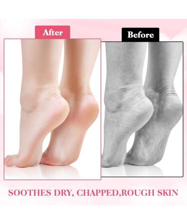 2Pairs Silicone Socks for Dry Cracked Feet Women Moisturizing Foot Socks Soft Gel Socks Aloe Socks Women's Spa Pedicure Foot Care Socks for Repairing Dry Feet Cracked Heel and Softening Rough Skin - Buy Online on GoSupps.com