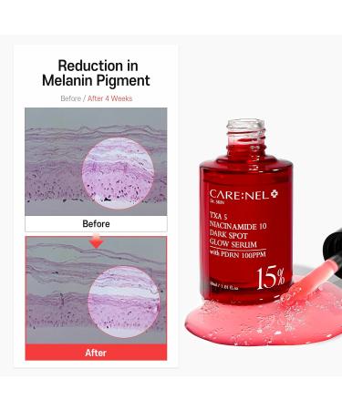 PDRN Serum TXA 5% Niacinamide 10% Pink Korean Skincare Dark Spot Hyaluronic Acid Vitamin B5 Panthenol Ceramide Uneven Skin Tone Radiant Complexion Glass Skin (30ml / 1.01 fl oz) - Buy Online on GoSupps.com