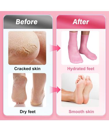Buy Silicone Moisturizing Socks for Dry Cracked Feet - Long Size High Elastic Anti-Slip Gel Spa Foot Care by MoyRetty (1 Pair) - International Shipping Available - Buy Online on GoSupps.com