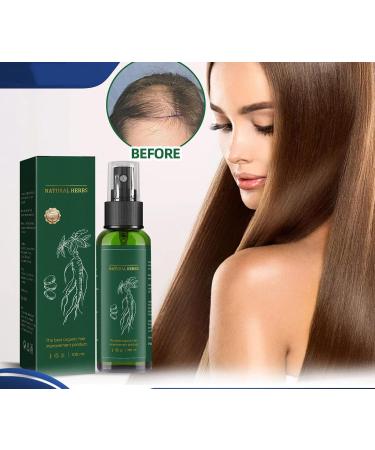 Ginseng Hair Tonic Ginger Hair Care Nutrient Solution Ginseng Hair Essential Oil Hair Growth Serum Spray Hair Growth for Men Women for Activating Dormant Hair and Follicles - Buy Online on GoSupps.com