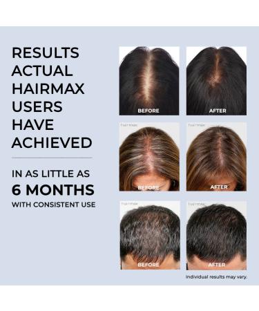 Hairmax LaserBand 41: FDA Cleared Hair Growth Laser for Men and Women - 100% Medical Grade Lasers, Not LEDs - Buy Online on GoSupps.com