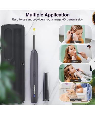 Ear Wax Removal Tool with 1300P FHD Camera - Ear Cleaner Kit for iPhone iPad & Android - Buy Online on GoSupps.com