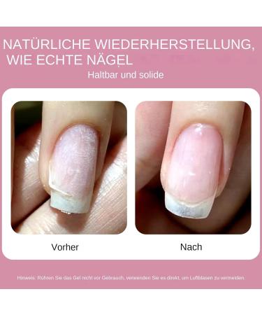 Broken Nail Repair Kit 5g file brush tweezers protective gel for nail repair nail file and brush set for daily manicure care - Buy Online on GoSupps.com