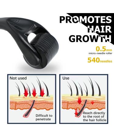 Salubohum Dermaroller Micro-Needle Roller Hair Dermaroller 0.5mm with 540 Microneedles Stainless Steel Suitable for Skin Care Hair Growth and Beard (Black) - Buy Online on GoSupps.com