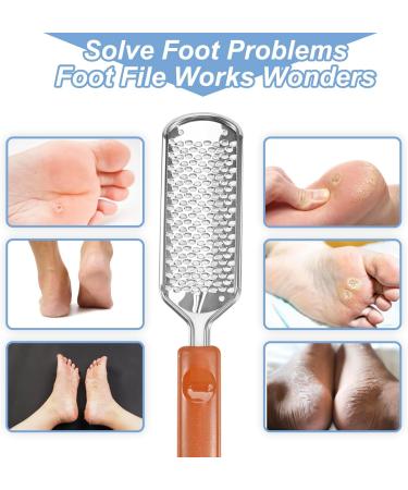 Untrytb Professional Foot Scrubber Dead Skin Remover Pedicure Foot File Callus Remover Heel Scraper for Cracked Heels Foot Rasp for Hard Skin Colossal Exfoliator Tool (T1) - Buy Online on GoSupps.com