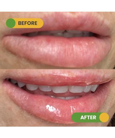 Nuzilicious Mango Lip Mask & Scrub Duo Hydrating & Exfoliating Lip Care with Omega Fatty Acids, Organic Oils & Organic Shea Butter Soft, Smooth, Plump Lips Vegan & Paraben-Free, No Nasties - Buy Online on GoSupps.com