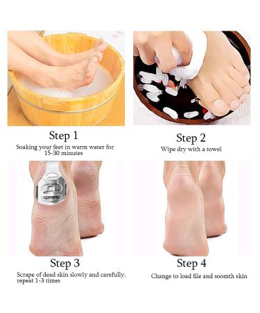 52 Pcs Callus Shaver Set - Stainless Steel Foot Razor with 50 Blades | Foot Care Tools for Hard Dry Skin Removal | Hand & Feet Callus Remover - Buy Online on GoSupps.com