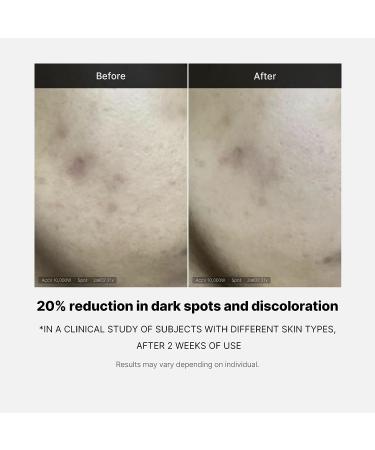 Medicube Deep Vita C Serum - Reduce Hyperpigmentation and Enhance Skin Radiance with 13.5% Pure Vitamin C - Buy Online on GoSupps.com