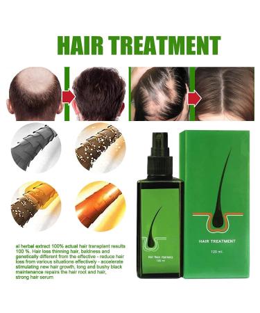 Organic Hair Growth Serum for Thinning Hair and Hair Loss - Nourishing Scalp Spray (120ml) - Buy Online on GoSupps.com