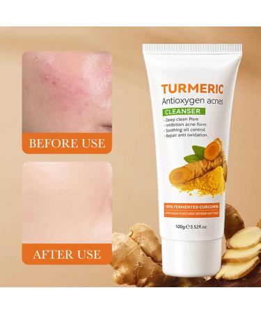 Turmeric Antioxygen Acnes Facial Cleanser Turmeric Face Wash for Gently Cleaning Pores Moisturising Cleanser Facial Cleanser Daily Makeup For All Skin Types 100g - Buy Online on GoSupps.com