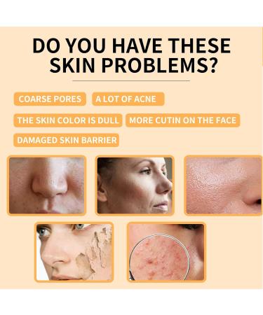 Glycolic Acid 7% Toning Solution with Hyaluronic Acid - Exfoliate, Brighten, and Rejuvenate - 240ml - Buy Online on GoSupps.com