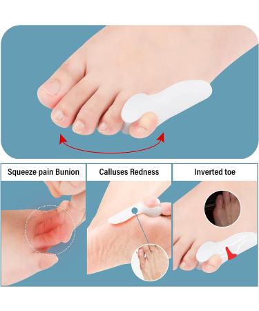 Pinky Toe Separator Gel Bunionette Protector - 6 PCS Tailors Bunion Little Toe Cushions for Pain Relief and Corn Callus Blisters - Buy Online on GoSupps.com