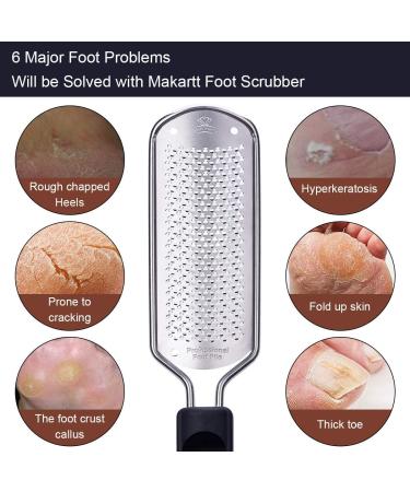 MAKARTT Fine Callus Remover - Premium Pedicure Foot File for Coarse Skin | International Shipping Available - Buy Online on GoSupps.com