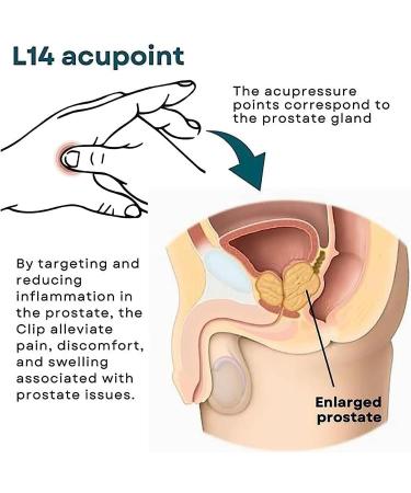 Prostate Care Point Clip - Acupressure Relief for Prostate Problems Tension & Anxiety (1 Piece) - Buy Online on GoSupps.com