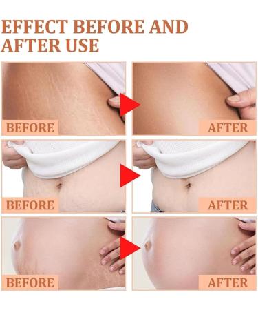 Le s rum True Abs Une Huile raffermissante et hydratante pour Le Ventre am liore l' lasticit r duit Les vergetures et Le rel chement cutan . Convient Tous Les Types de Peau. - Buy Online on GoSupps.com