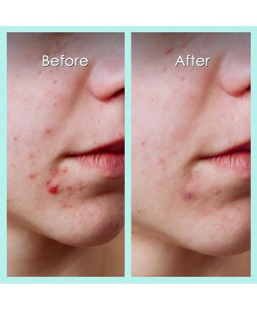 CHOK BEAUTY Double Blemish | Award winner | Vegan Cruelty-Free | Quality Guarantee | UK Brand - Buy Online on GoSupps.com