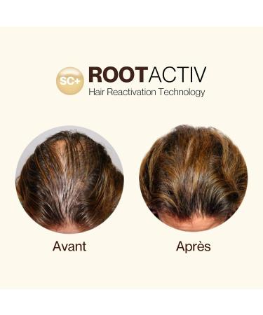 S rum de croissance capillaire base de cellules souches - Pr vention de la chute des cheveux - Traitement naturel de croissance capillaire - R duit la perte de cheveux - 75 mL - Buy Online on GoSupps.com