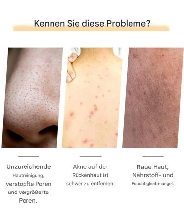  Generisch turmeric face soap turmeric honey soap moisturizing face soap face soap face soap moisturizing soap facial cleanser deep cleansing bar for women - Buy Online on GoSupps.com