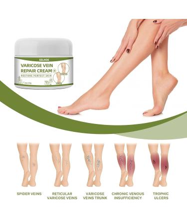 Best Varicose Veins Cream | Spider Vein Treatment | Repair Cream for Legs | 50g International Shipping - Buy Online on GoSupps.com