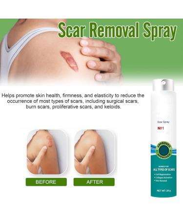 Heal Scar Care Spray | Advanced Formula for All Scar Types | 80g - Enhance Healing & Reduce Visibility - Buy Online on GoSupps.com