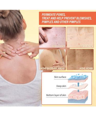 Kojic Acid Soap - Kojic Acid Skin Lightening Soap - Kojic Acid Dark Spot Remover Soap Bar - Reduce Hyperpigmentation Anti Oxidation Even Skin Tone - Moisture Hydrate Restore Elasticity Reduce Dryness - Buy Online on GoSupps.com