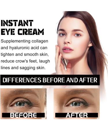 2Pcs Waken Peptide Lifting Eye Gel Open Eye Waken Peptide Depuffing Eye Gel Men's Peptide Anti Aging Eye Serum Lifts Firming Anti-wrinkle Eye Tightener Reduces Puffiness & Dark Circles - Buy Online on GoSupps.com
