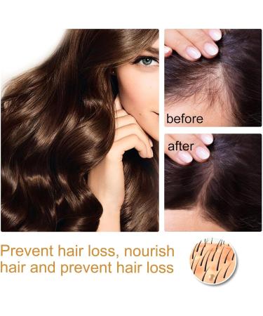 QDHGCFOC Rice Water Hair Oil Hair Serum Natural Rice Essence Nourishing Hair Serum Natural Rice Milk Serum Strengthens Scalp Improves Hair Condition - Buy Online on GoSupps.com