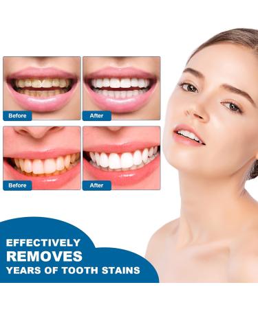 Teeth Whitening Pen Set - 3pcs Whitening Gel Essence for Stain Removal & Yellowing Reduction - Buy Online on GoSupps.com