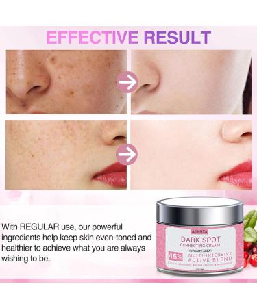 Skin Lightening Cream - Face Cream for Women - Dark Spot Corrector Remover - Face moisturizer for Anti Aging & Anti Wrinkles - Improve and Evens Skin Tone (50ml) - Buy Online on GoSupps.com