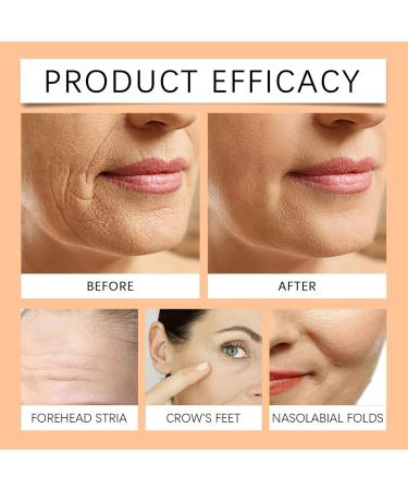 Roll On Facial Serum For Under Eyes and Face with Organic Cold Pressed Frankincense Resin Infused Oil Castor Oil and Frankincense Roll Ball - Anti-Aging Time Eraser Oil 10mL (10ml 2pc) - Buy Online on GoSupps.com