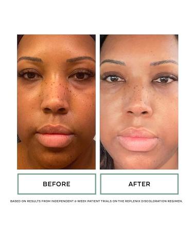 Replenix Redness Reducing Triple AOX Cream | Hydrating Antioxidant Treatment for Sensitive Skin | 1 fl. oz - Buy Online on GoSupps.com