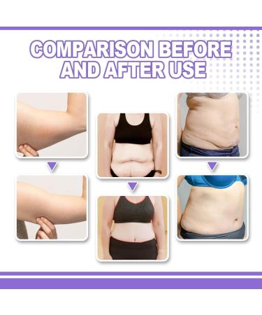 Collagen Firming Body Cream - Collagen Pro Body Moisturizing Cream - Luxelift Lift & Firm Body Cream - Luxurious Collagen Beauty Cream - Natural Moisturizing Cream - Buy Online on GoSupps.com