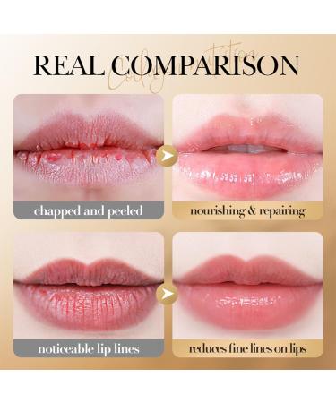 Virecose Lip Balm 8 Protective Lip Balm with Soft Finish 5 g - Buy Online on GoSupps.com