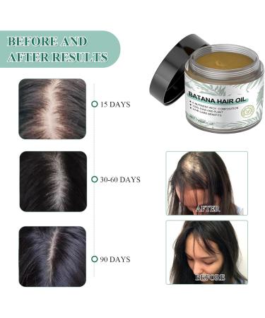 Nadiaen Batana Oil For Hair Growth Raw Batana Oil 100% Pure Unrefined Hair Mask Natural Organic Botana Oil from Honduras Hair Growth Conditioner for Scalp Hair Care for Women Men Repairs Damaged - Buy Online on GoSupps.com