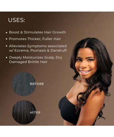 Sunny Isle Jamaican Black Castor Oil 100% Pure for Hair, Eyelashes & Eyebrows - 4 oz - Buy Online on GoSupps.com