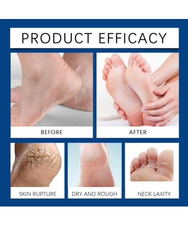  Byeaon Foot Callus Removal Gel Cracked Heel Relief Foot Moisturizing Gel Gentle Yet Powerful Formula Compact and Convenient 100g For Men and Women - Buy Online on GoSupps.com