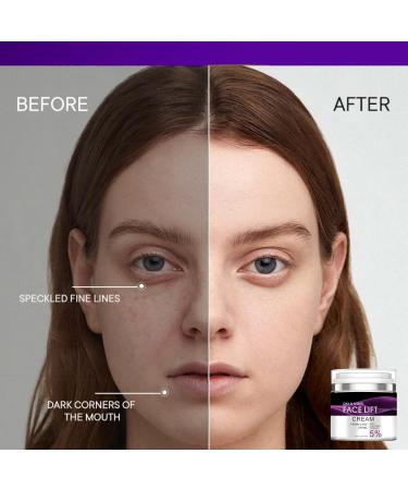 Face Lift Cream with Collagen Complex 5% Retinol Face Cream with Collagen Collagen Boost Face Moisturiser Retinol Night Cream for Women Anti Aging Firming Night Cream for Repair Serums Skincare - Buy Online on GoSupps.com