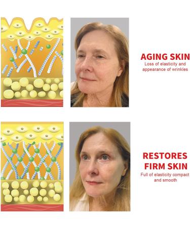 Niacinamide Serum Facial Serum Against Pigment Spots Anti-Aging Dark Spots Anti Wrinkle Serum Facial Serum Moisturizing Firming Anti Wrinkle Effect Essence - Buy Online on GoSupps.com