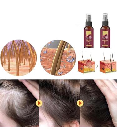  Jesshiny Red onion hair oil organic red onion oil serum spray for healthier hair moisturizing and non-greasy strengthens hair roots reduces hair breakage 30 ml - Buy Online on GoSupps.com