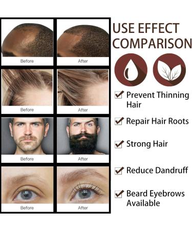 Hair Growth Oil Thinned Hair Liquid Grow Hair Deeply Nourishing Scalp Stimulates Hair Growth Trengthen Hair Roots Moisturize & Repair Dry Damaged Hair Care Hair Growth Serum for All Hair Types - Buy Online on GoSupps.com