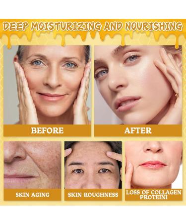 Bee Venom Skin Cream New Upgrade 2pcs 60g Multipurpose Bee Venom Skin Treatment Cream for Repair Moisturize and Lift - Buy Online on GoSupps.com