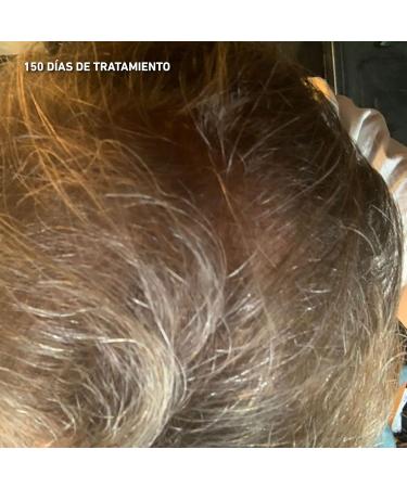 HEY JOE! - Power Hair Lotion | Anti-hair loss lotion formulated with plant stem cells Cruelty Free and vegan - 150 ml - Buy Online on GoSupps.com