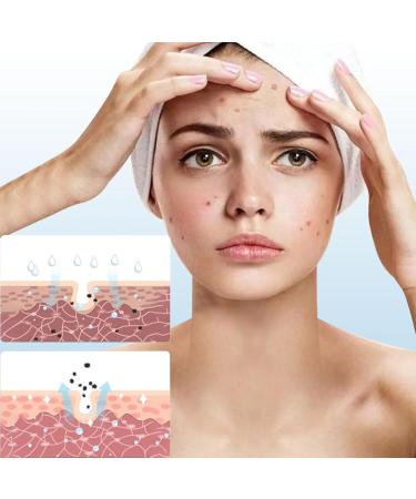 Giugio B5 creams B5 Repair Creme B5 Face Serum B5 Repairing Cream Deep moisturizing face cream soothing and fading acne pressure marks to repair damaged skin - Buy Online on GoSupps.com