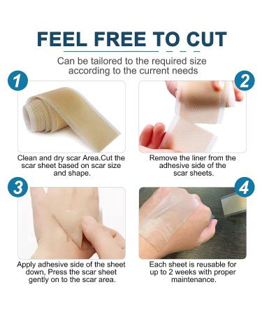 Medical Grade Silicone Scar Sheets - Reusable Gel Tape for Effective Scar Removal - 120x1.6 Roll, Skin Color - Buy Online on GoSupps.com