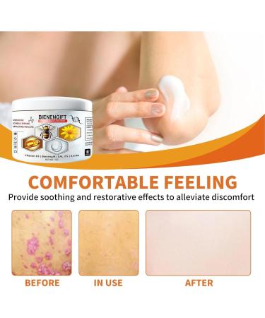  G n rique Multi-Symptom Care Cream with Bees Moisturizing Face and Body Cream Fast Absorbing Hydrates and Fights Dryness for All Skin Types - Buy Online on GoSupps.com