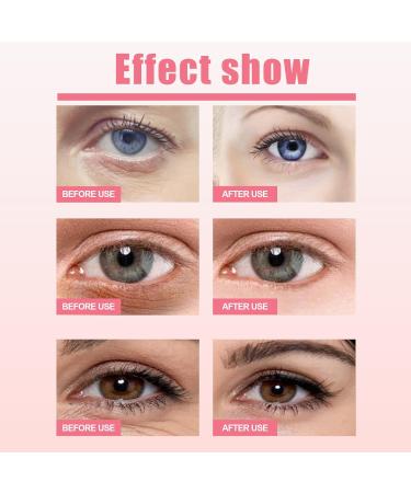 Shantou Yingji Eye cream for wrinkles antiaging eye cream for the face cream for fine lines and dark circles eye care for normal to dry skin eye cream for men and women 3 g eye cream 1 - Buy Online on GoSupps.com