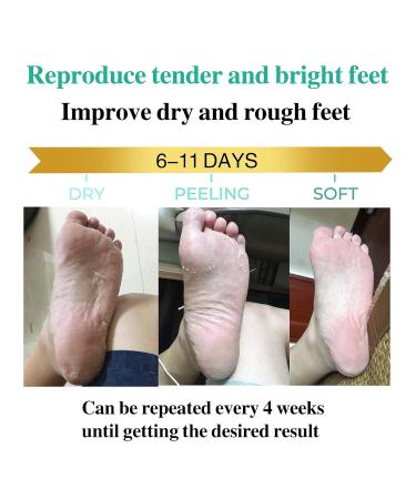 SKINATURE CARE Foot Peel Mask 3 Pack - Exfoliating Foot Mask for Cracked Heels - Moisturizing & Repairing Rough Heels - Lavender Scent - 3 Pairs - Buy Online on GoSupps.com